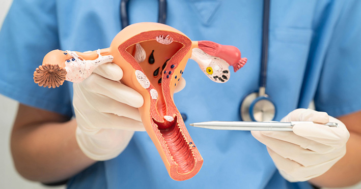 Fertility care – IUI (intrauterine insemination) treatment