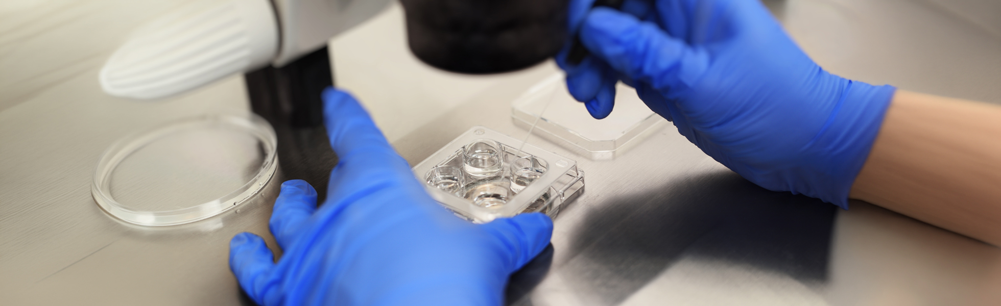 IVF (in vitro fertilisation) treatment