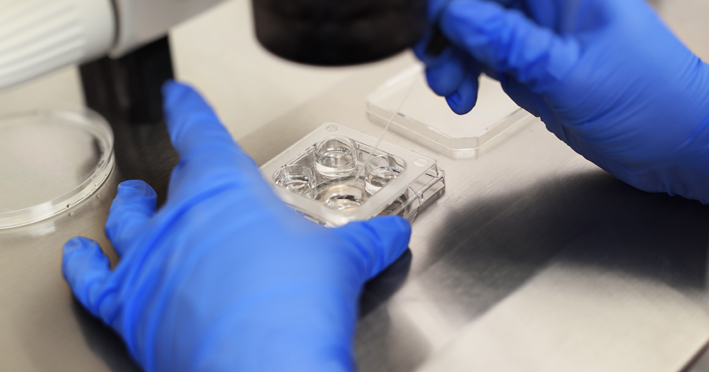 IVF (in vitro fertilisation) treatment