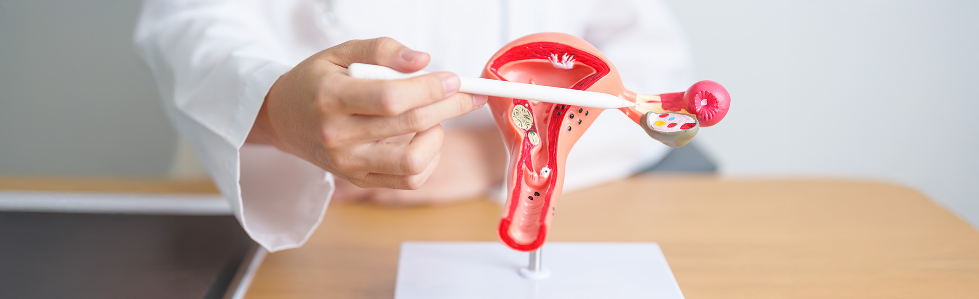 Ovarian cysts treatment