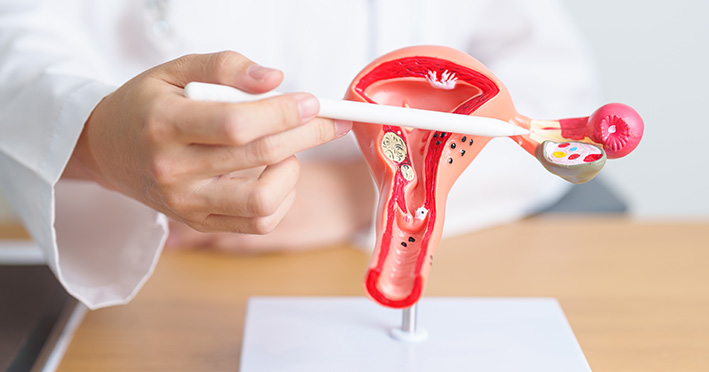 Ovarian cysts treatment